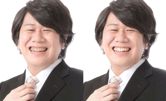 ホワイトニングイメージ